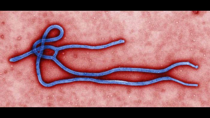 800px-Ebola_virus_virion