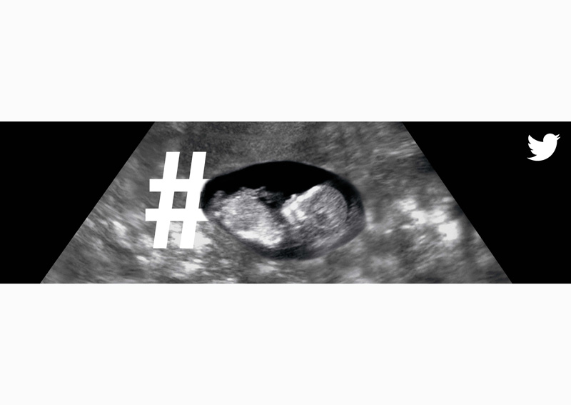 A12-007-00625-SONOGRAM
