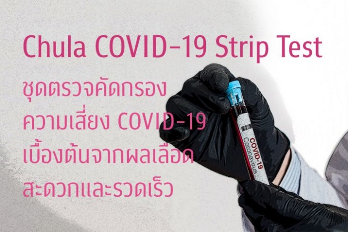 Chula COVID-19